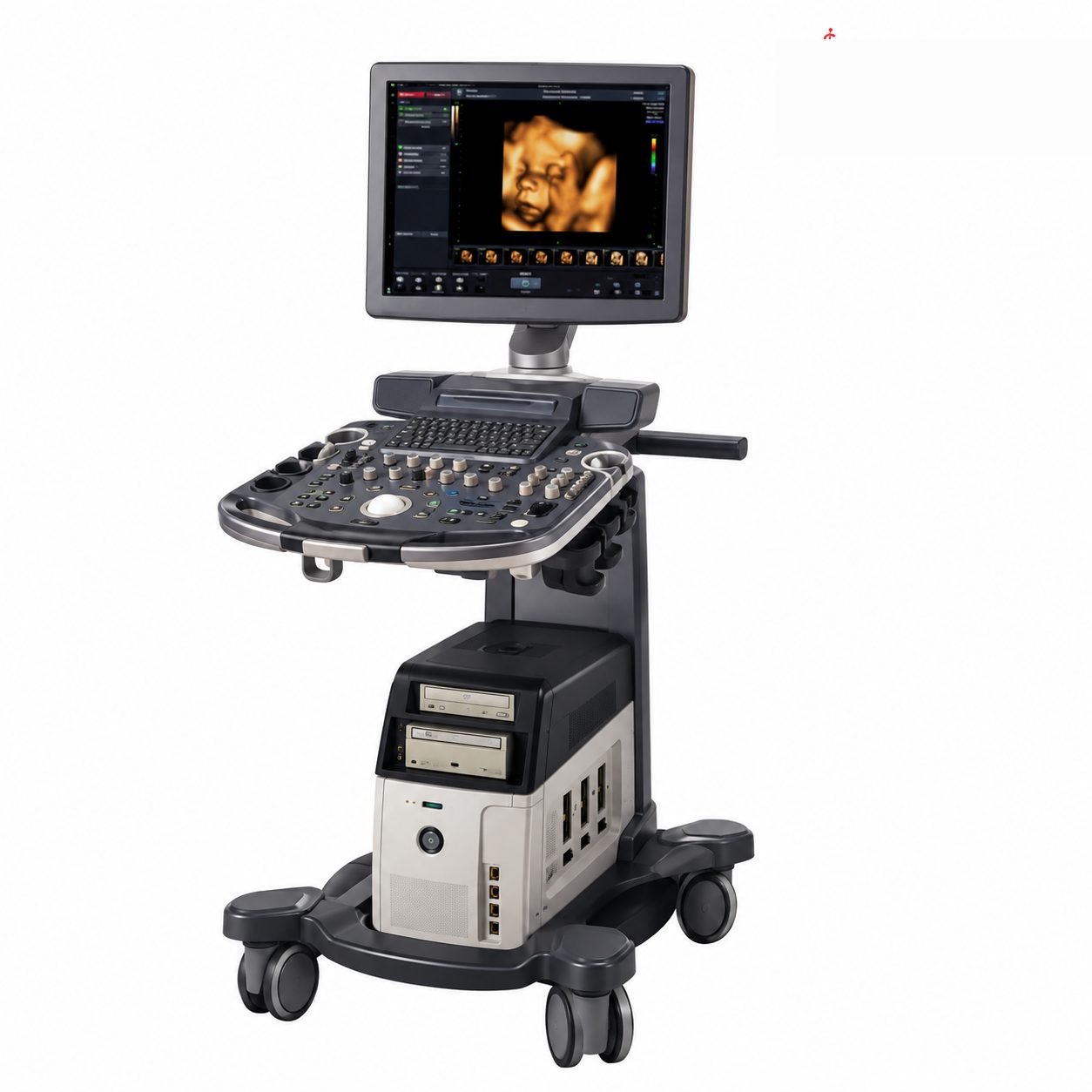GE ultrasound system