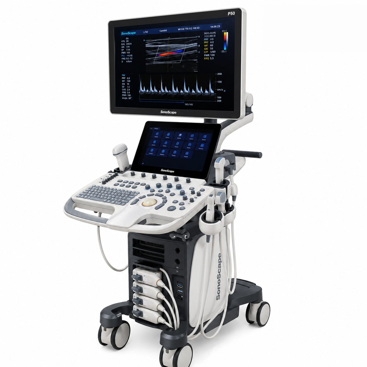SonoScape P50 ultrasound system
